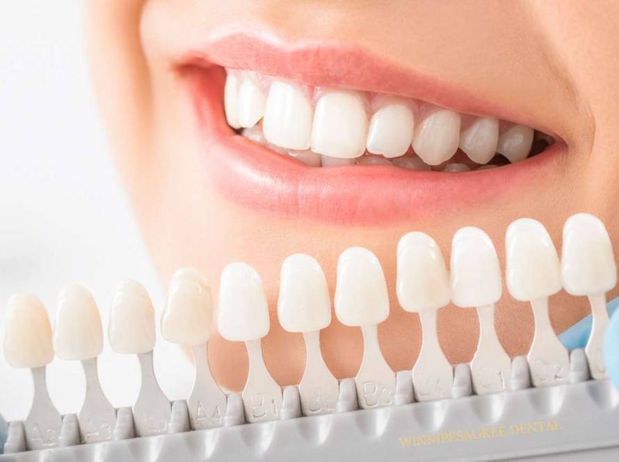 whitening